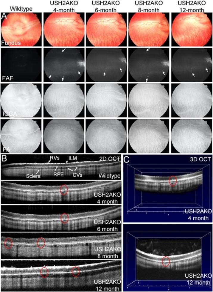 Retinal imaging in USH2A KO rabbit.